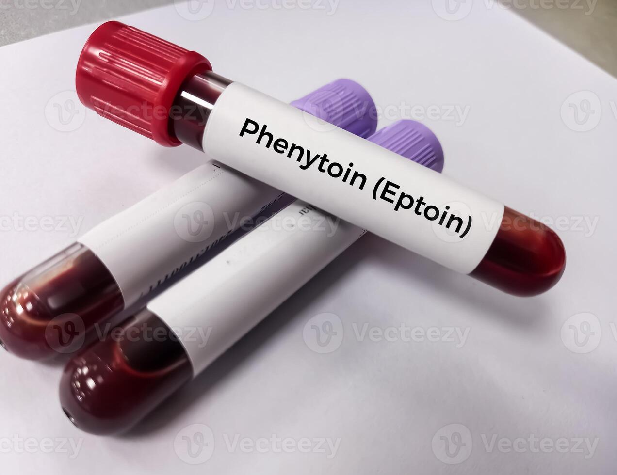 Blood sample for Phenytoin test, therapeutic drug, to maintain a therapeutic level and diagnose potential for toxicity photo