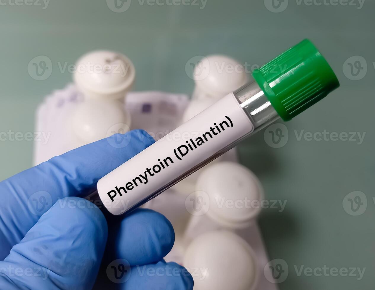 Blood sample for Phenytoin test, therapeutic drug, to maintain a therapeutic level and diagnose potential for toxicity photo