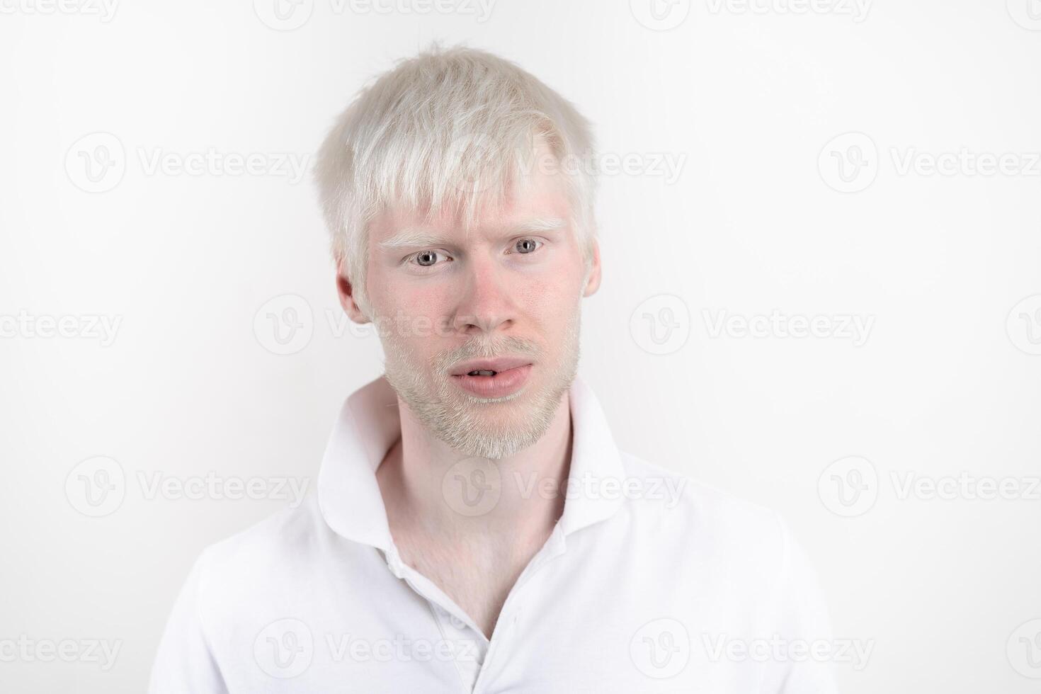 retrato de un albino hombre en estudio vestido camiseta aislado en un blanco antecedentes. anormal desviaciones raro apariencia foto