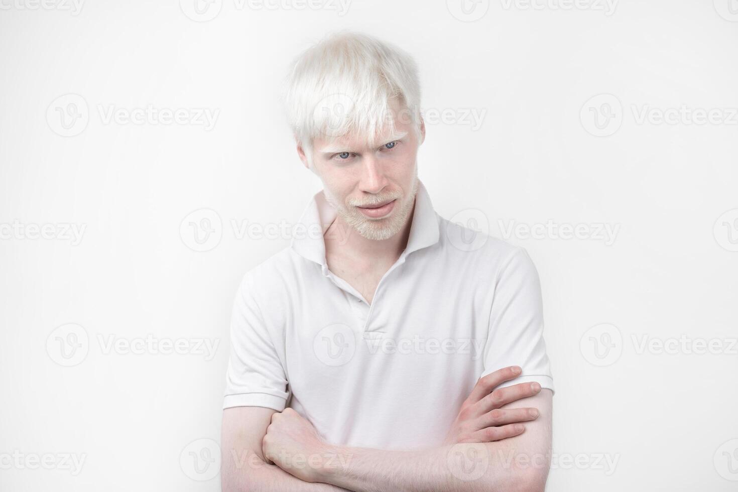 retrato de un albino hombre en estudio vestido camiseta aislado en un blanco antecedentes. anormal desviaciones raro apariencia foto