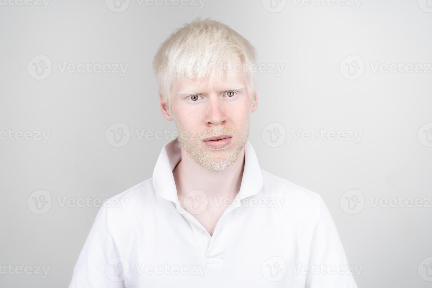 portrait of an albino man in  studio dressed t-shirt isolated on a white background. abnormal deviations. unusual appearance photo