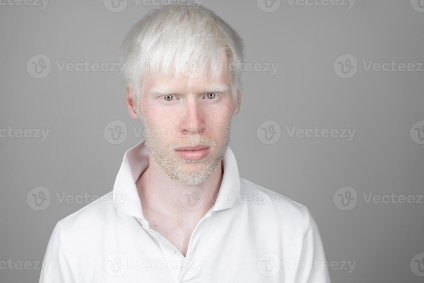 portrait of an albino man in  studio dressed t-shirt isolated on a white background. abnormal deviations. unusual appearance photo