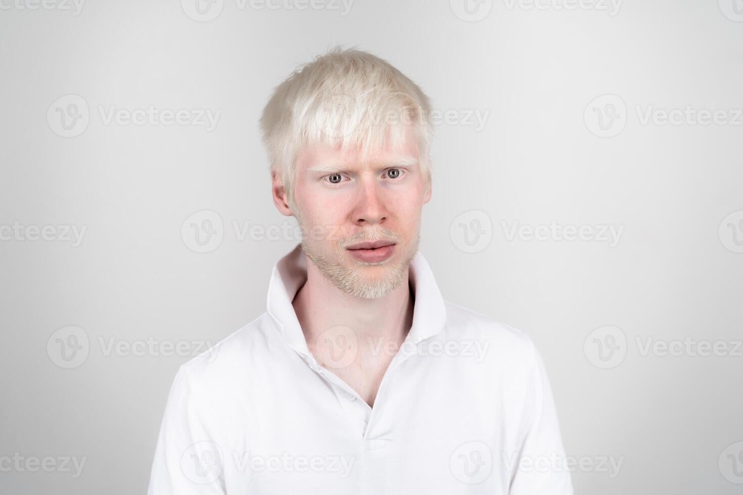 retrato de un albino hombre en estudio vestido camiseta aislado en un blanco antecedentes. anormal desviaciones raro apariencia foto