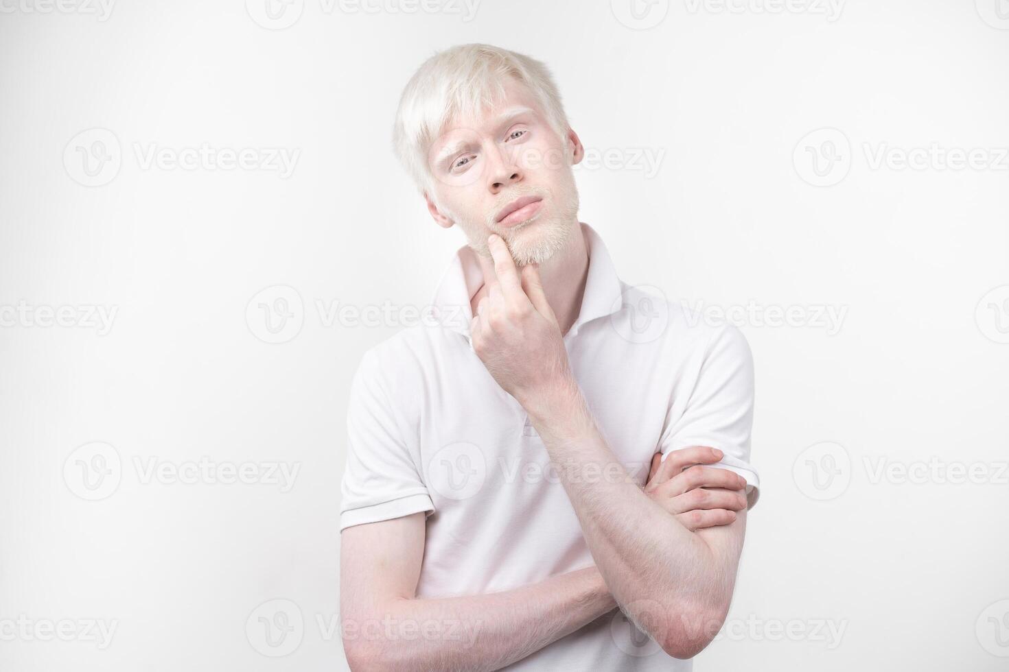 portrait of an albino man in  studio dressed t-shirt isolated on a white background. abnormal deviations. unusual appearance photo