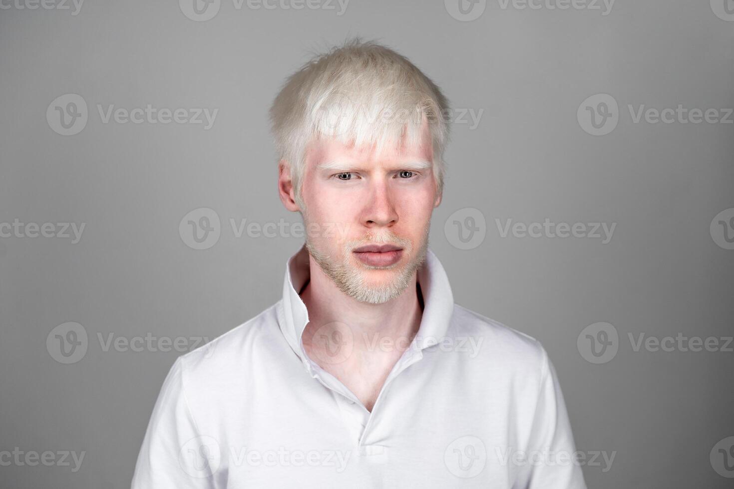 retrato de un albino hombre en estudio vestido camiseta aislado en un blanco antecedentes. anormal desviaciones raro apariencia foto