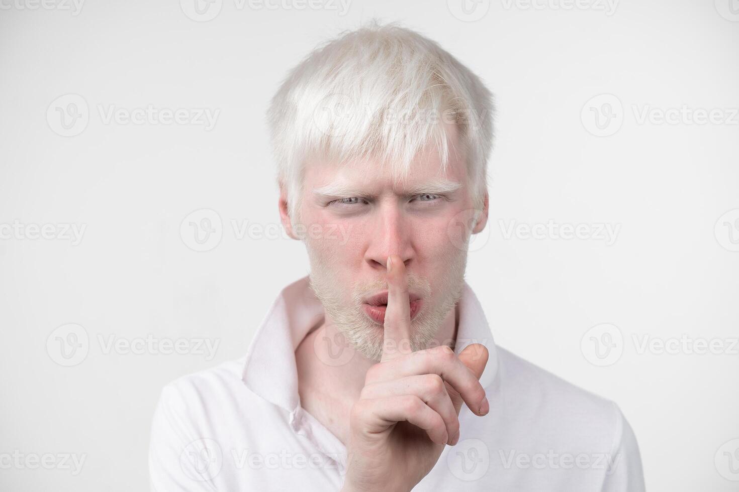 retrato de un albino hombre en estudio vestido camiseta aislado en un blanco antecedentes. anormal desviaciones raro apariencia foto