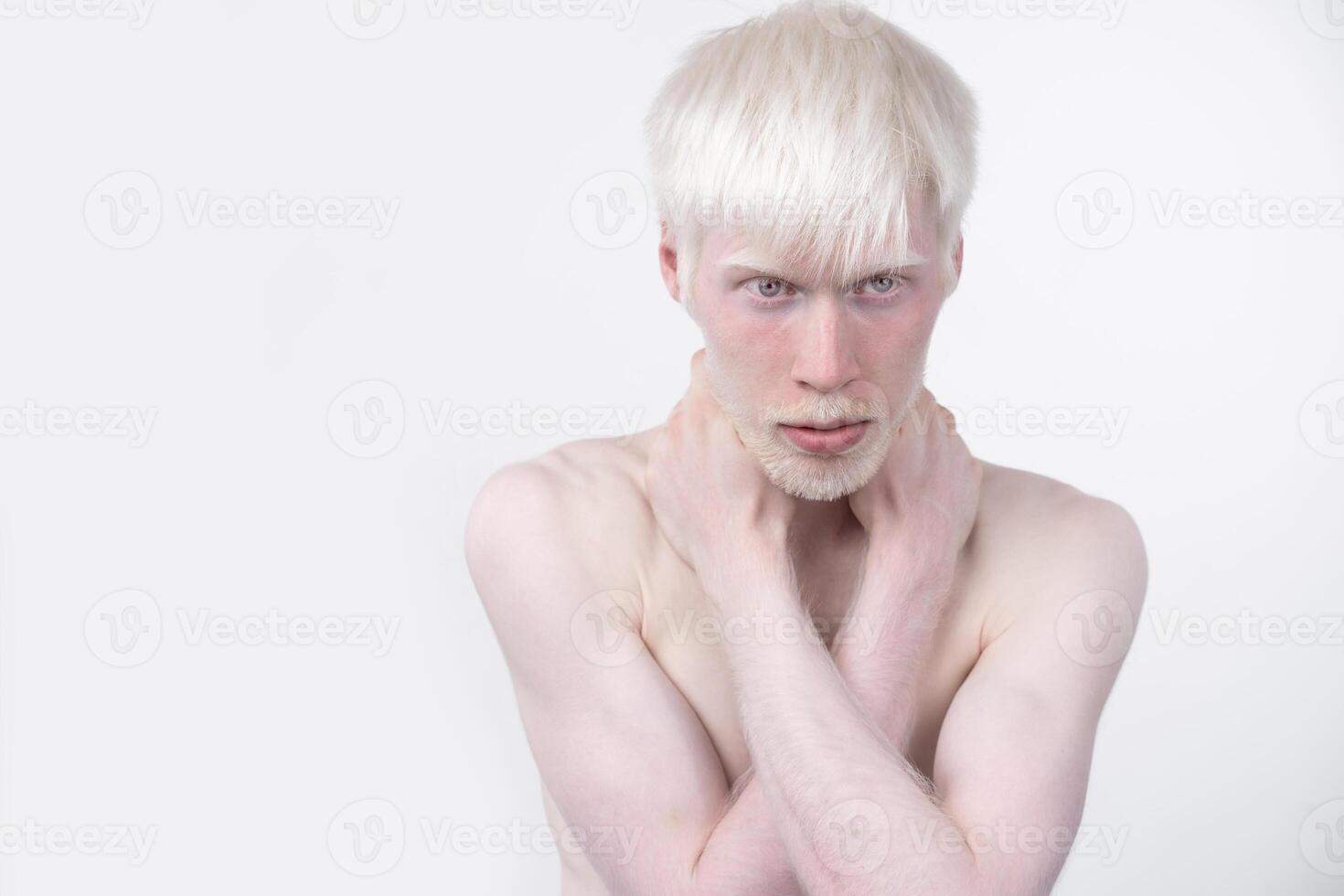 portrait of an albino man in  studio dressed t-shirt isolated on a white background. abnormal deviations. unusual appearance photo