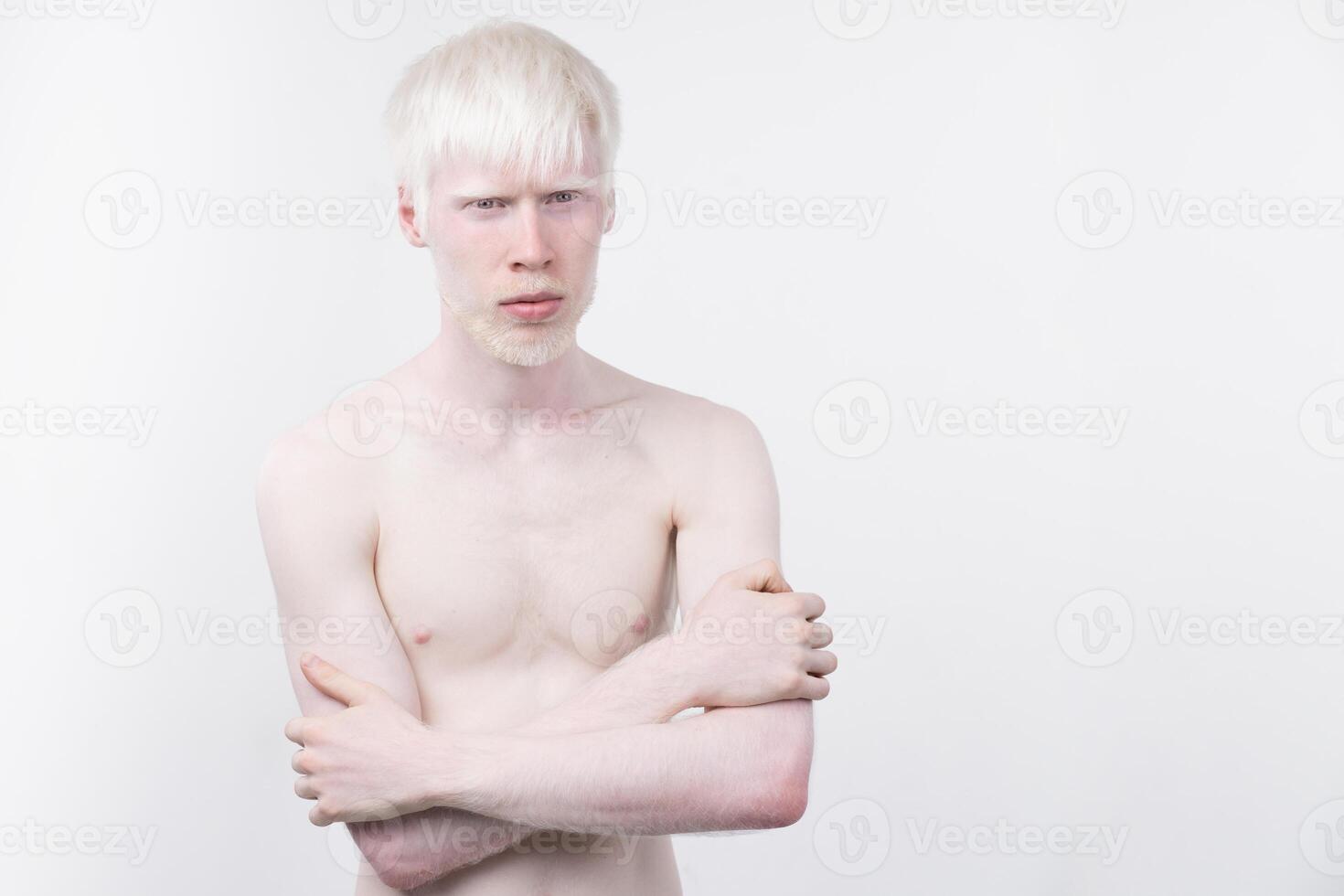 retrato de un albino hombre en estudio vestido camiseta aislado en un blanco antecedentes. anormal desviaciones raro apariencia foto