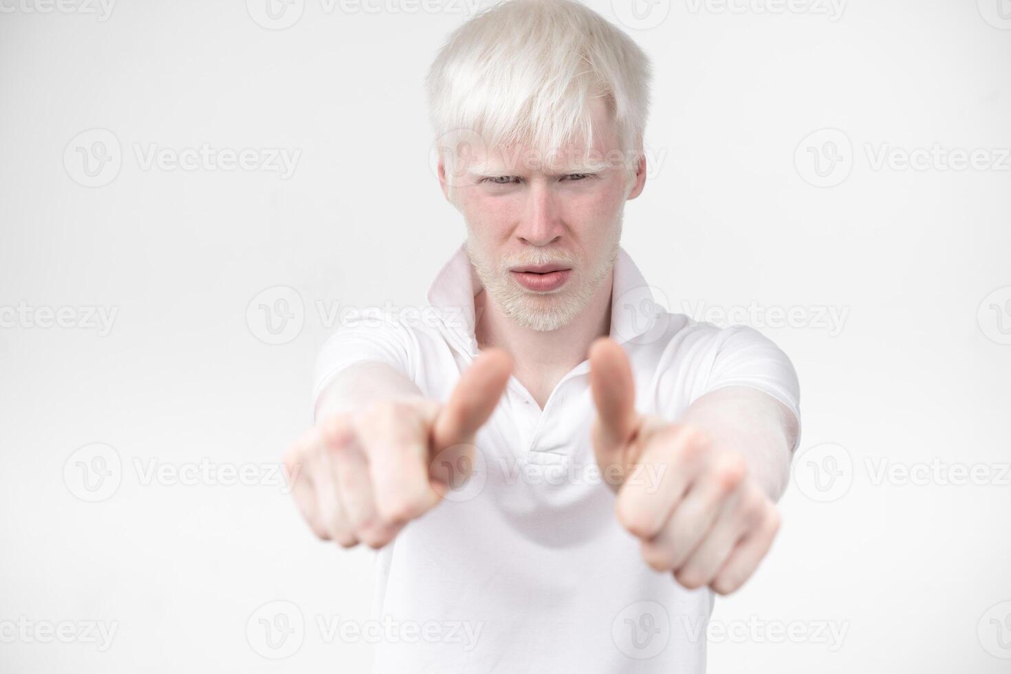 portrait of an albino man in  studio dressed t-shirt isolated on a white background. abnormal deviations. unusual appearance photo