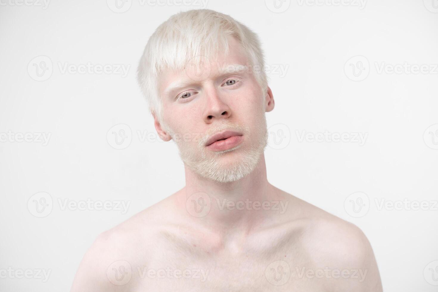 portrait of an albino man in  studio dressed t-shirt isolated on a white background. abnormal deviations. unusual appearance photo