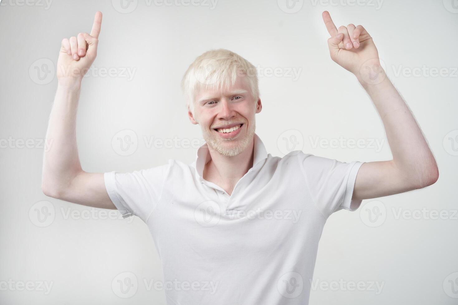 portrait of an albino man in studio dressed t-shirt isolated on a white background. abnormal deviations. unusual appearance photo