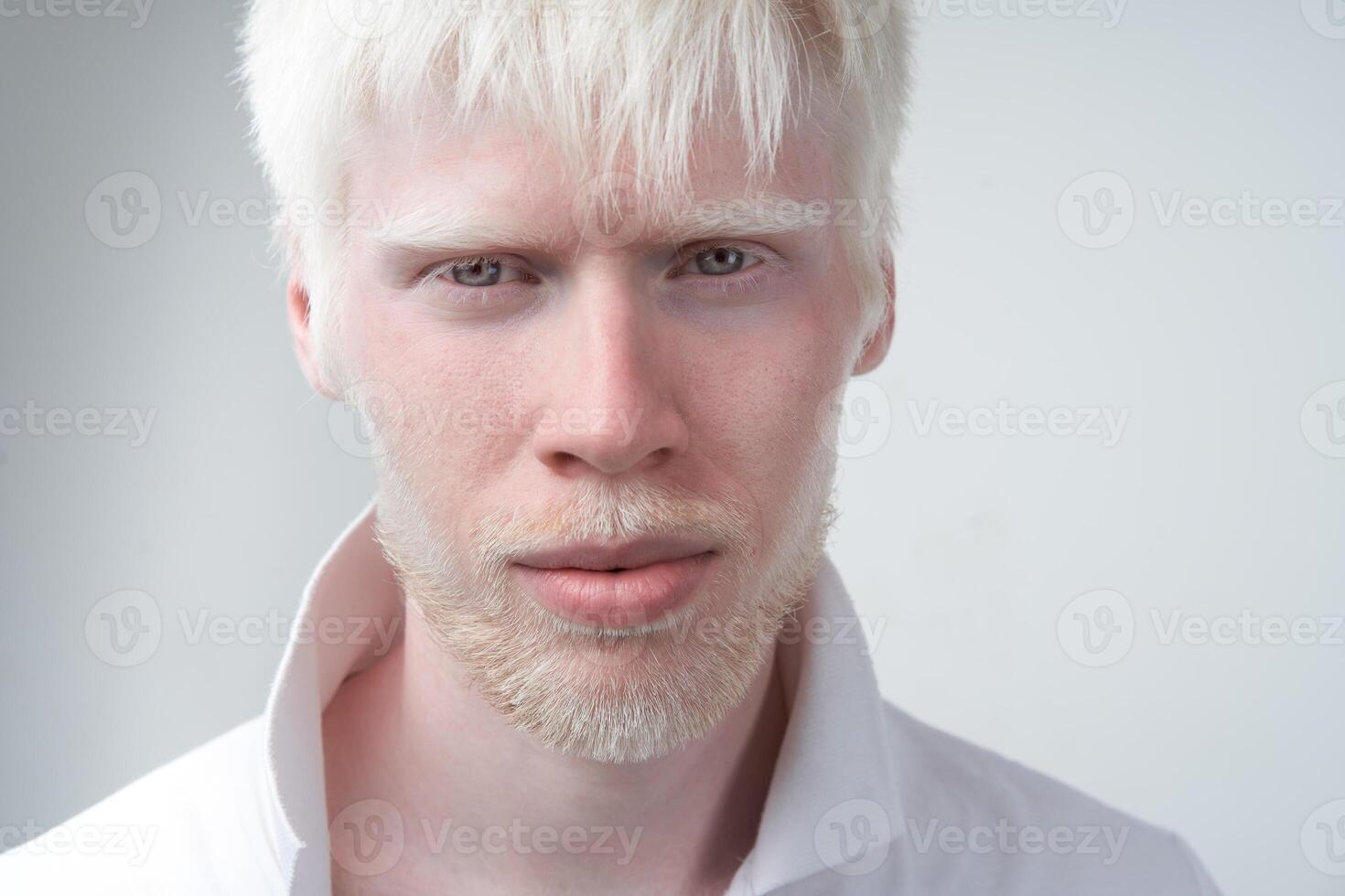 retrato de un albino hombre en estudio vestido camiseta aislado en un blanco antecedentes. anormal desviaciones raro apariencia foto