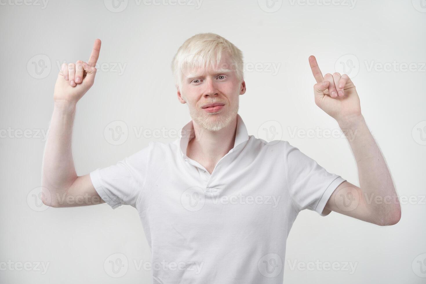 albinismo albino hombre en estudio vestido camiseta aislado en un blanco antecedentes. anormal desviaciones raro apariencia foto