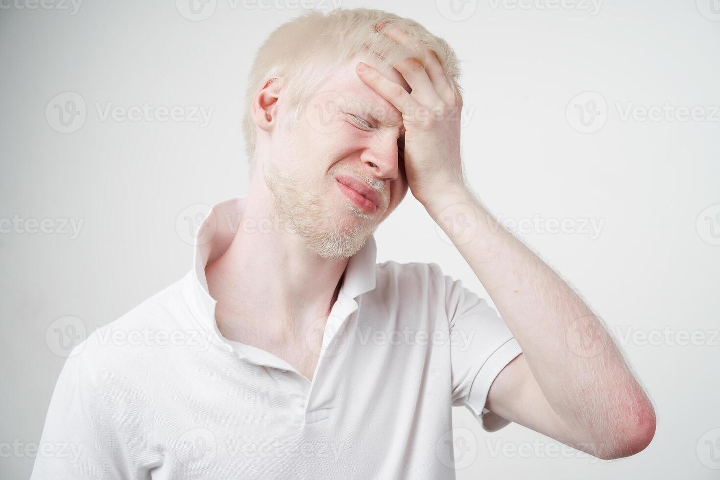 albinismo albino hombre en estudio vestido camiseta aislado en un blanco antecedentes. anormal desviaciones raro apariencia foto