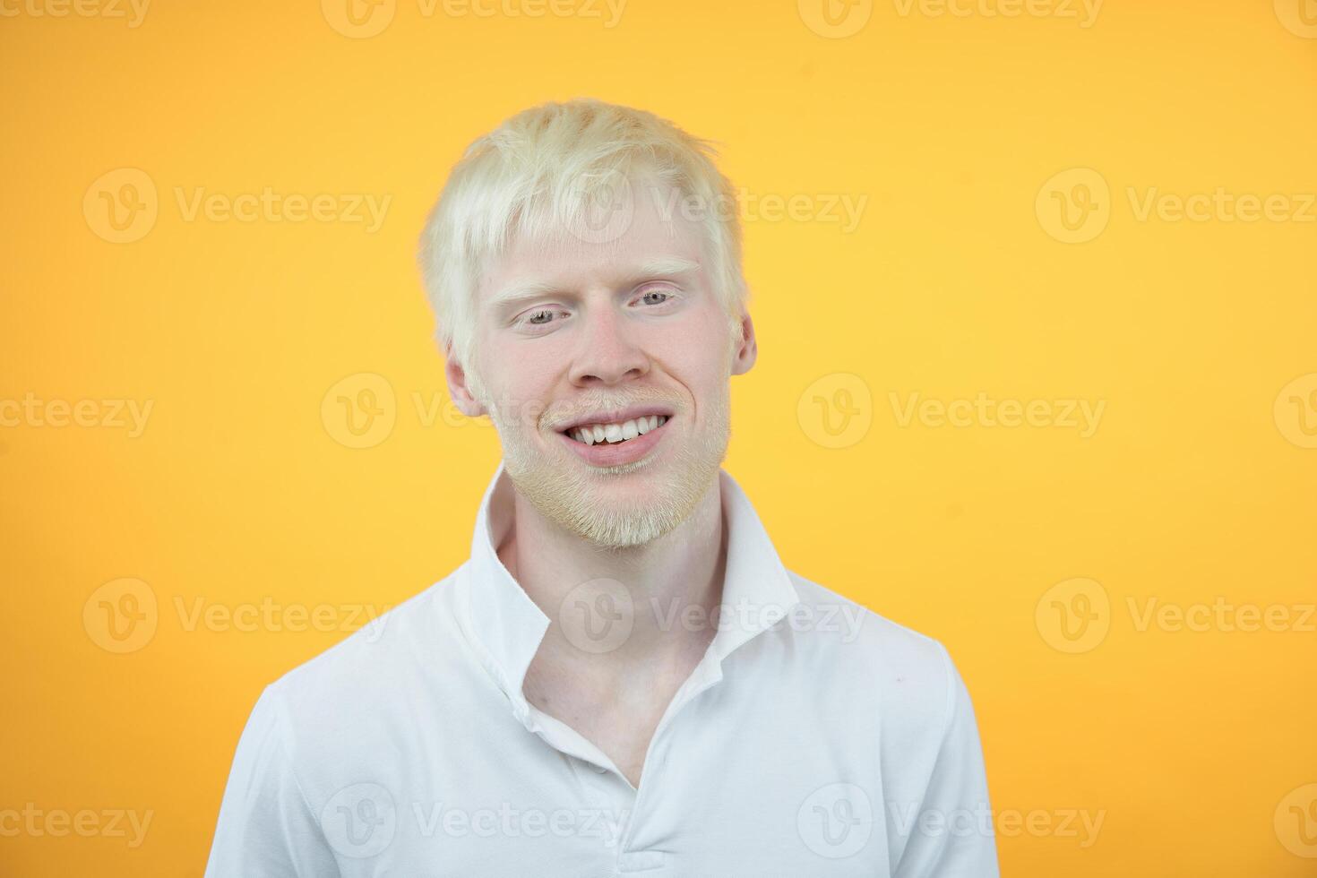 portrait of an albino man in studio dressed t-shirt isolated on a yellow background. abnormal deviations. unusual appearance photo