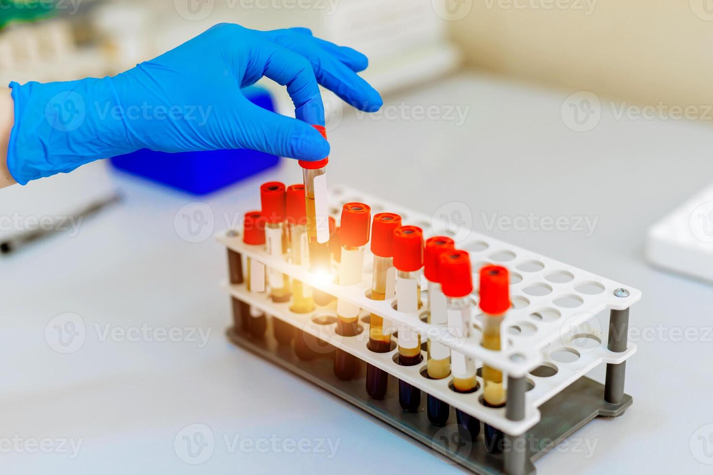 Blood samples for research in microtubes. Pneumonia diagnosting. COVID-19 and coronavirus identification. Pandemia. Centrifuge with screen. photo