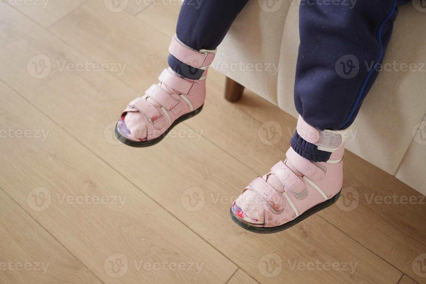 Child cerebral palsy disability with legs orthosis. shoes in her feet sitting on sofa photo