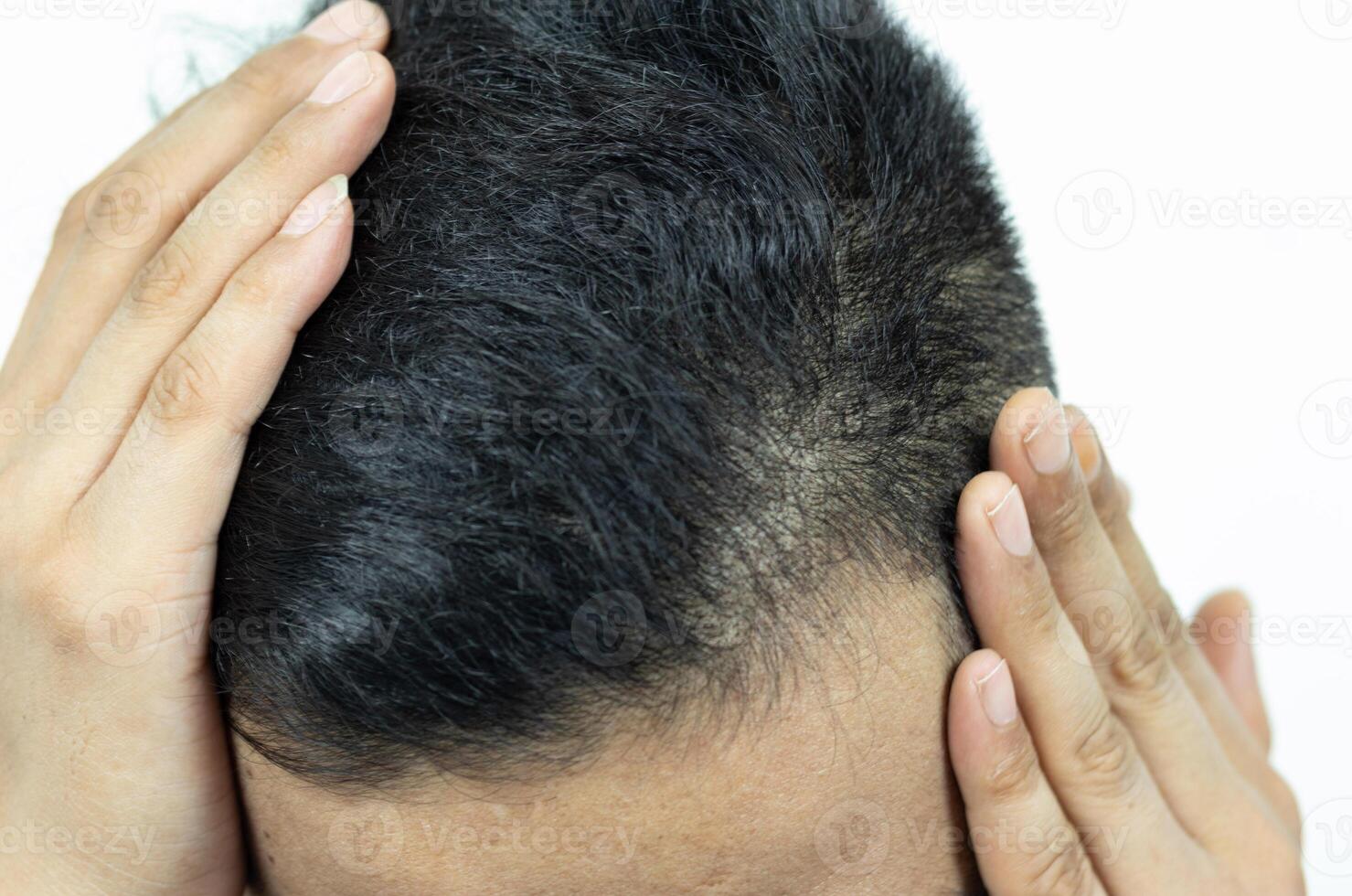 Close Up Young people have problems with hair loss, dryness, dullness, split ends and damage. photo