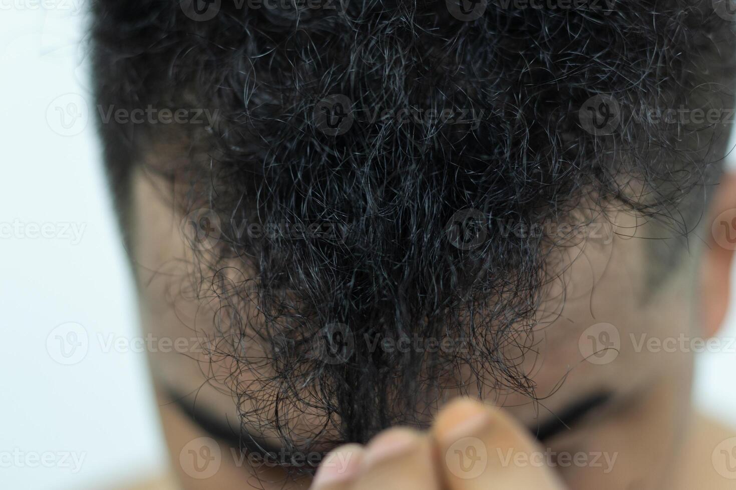 Close Up Young people have problems with hair loss, dryness, dullness, split ends and damage. photo