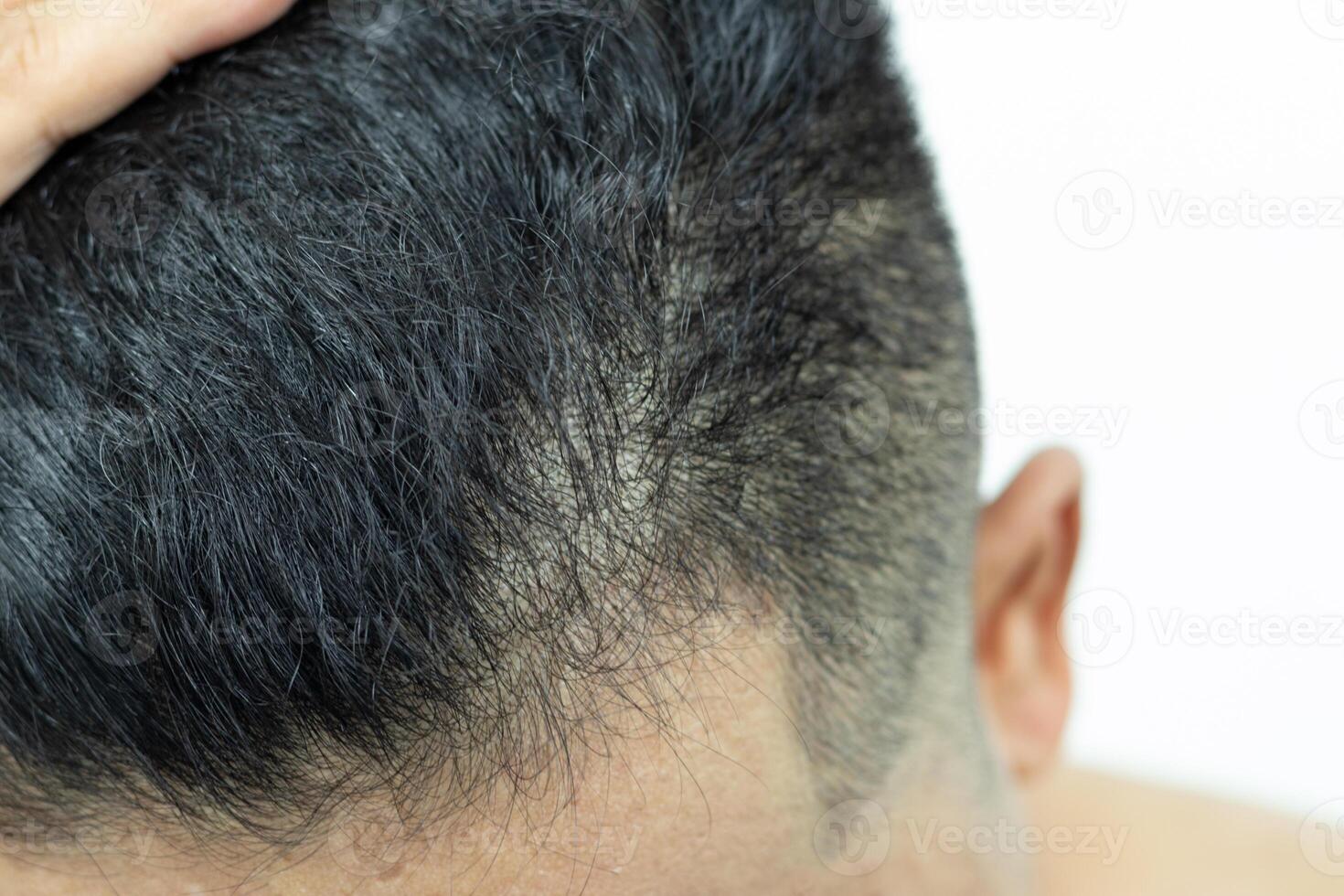 Close Up Young people have problems with hair loss, dryness, dullness, split ends and damage. photo