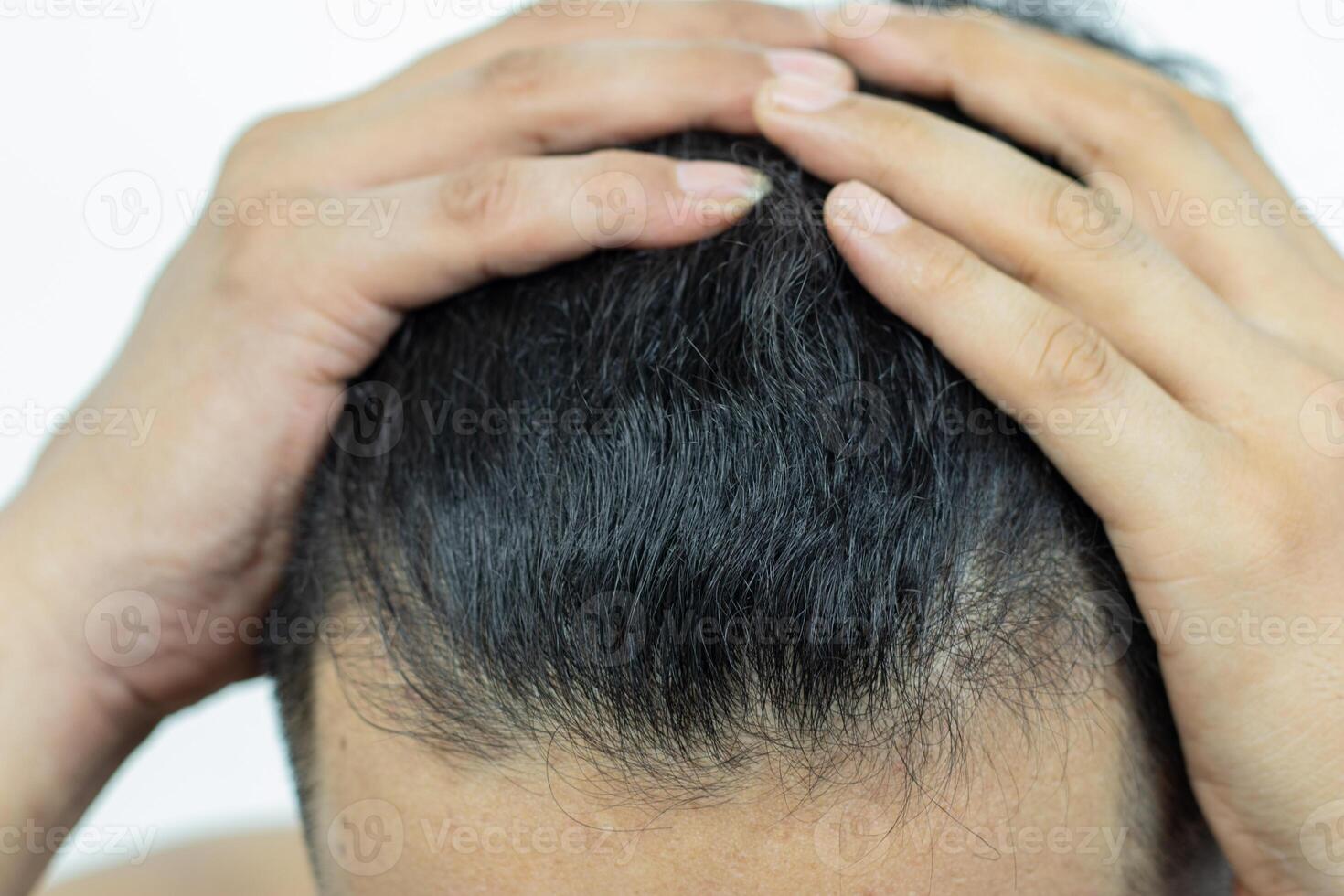 Close Up Young people have problems with hair loss, dryness, dullness, split ends and damage. photo