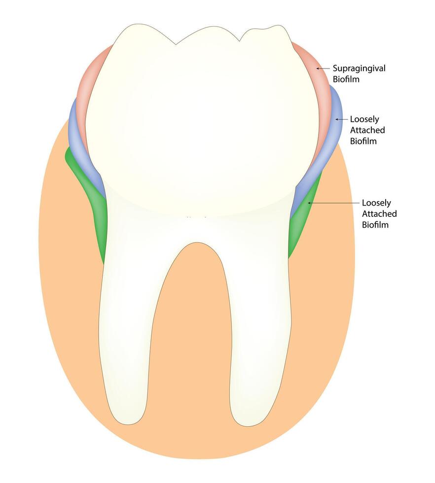 supragingival biopelícula Ciencias diseño vector ilustración diagrama