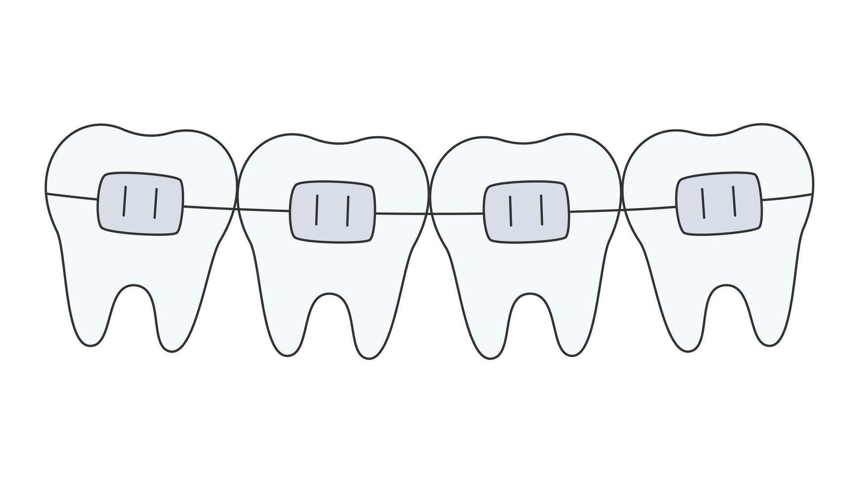 dientes fila con tirantes vector