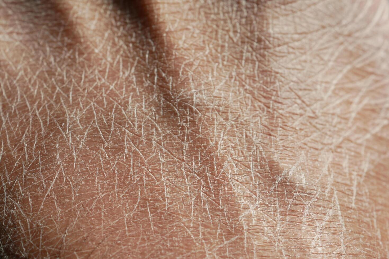 Closeup view of dry human skin . photo