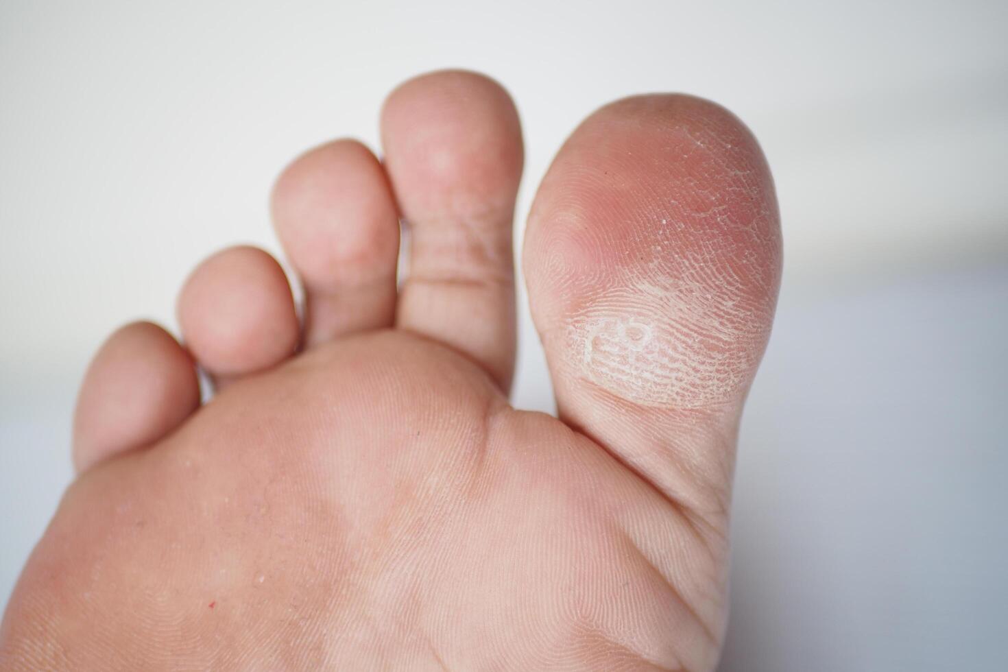 close up of young man dry feet on bed , photo