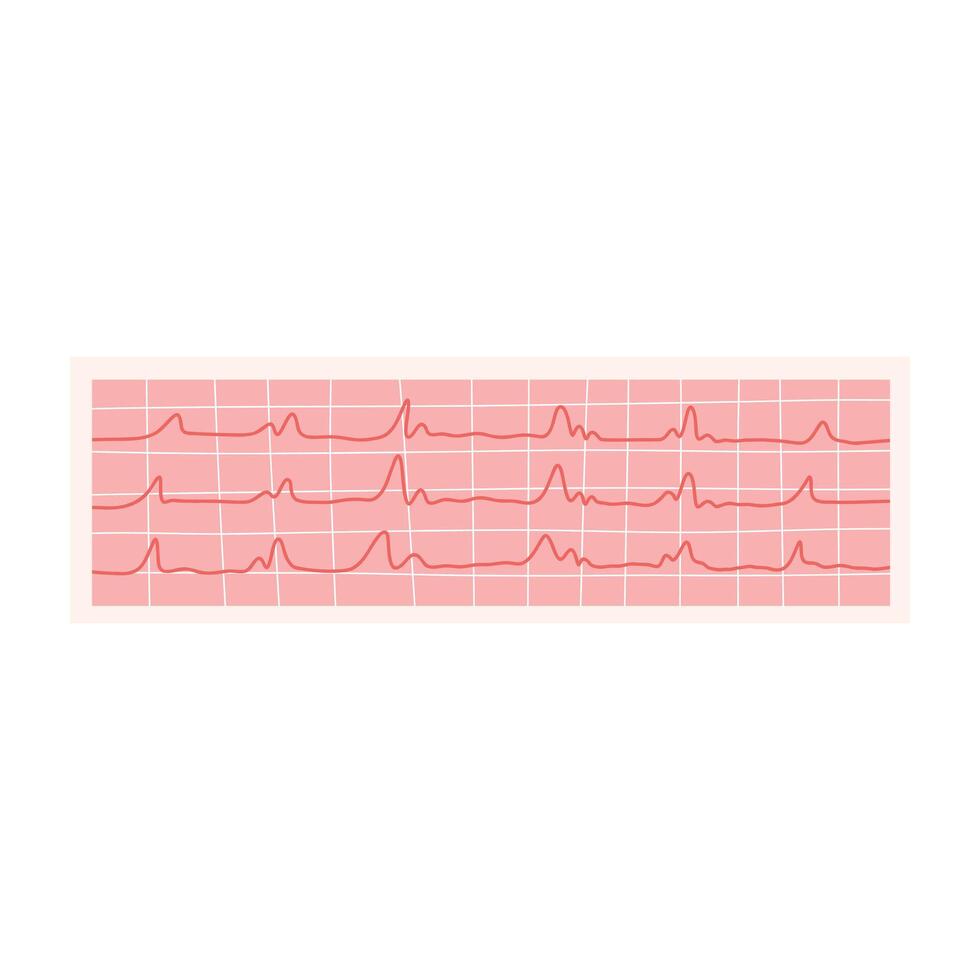 ECG illustration. Electrocardiogram isolated on a white background. vector
