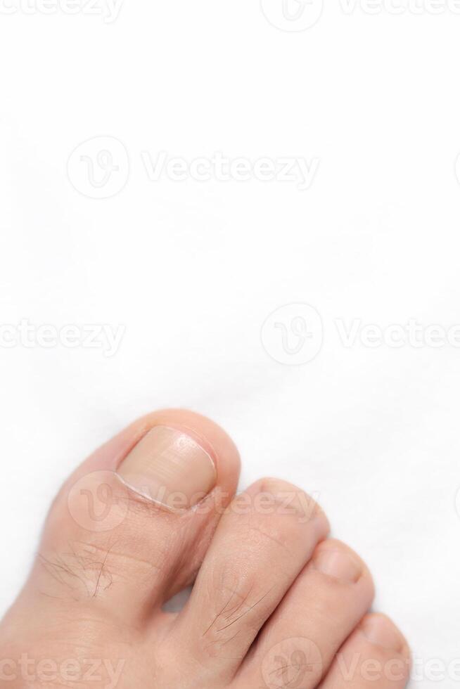 Closeup of a toe with white background and space above for text photo