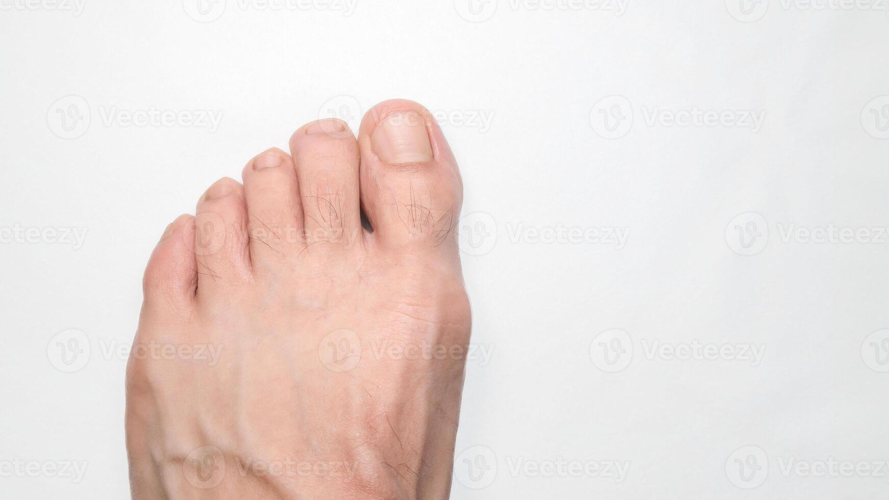 Close up of a person left foot toes with white background and space on the right for text photo