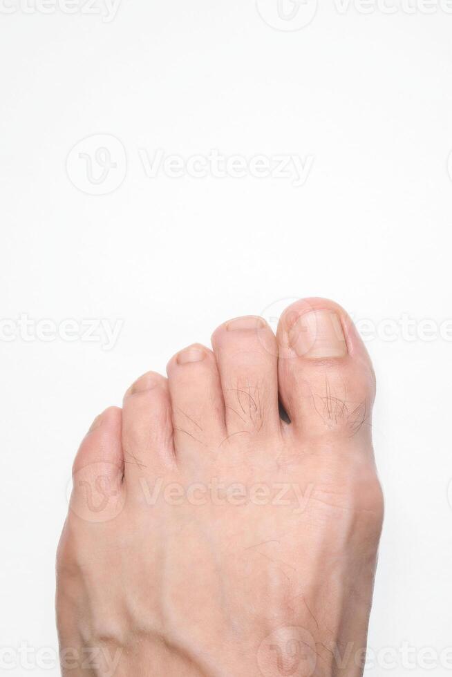 Close up of a person left foot toes with white background and space above for text photo