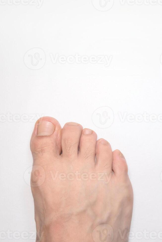 Close up of a person right foot toes with white background and space above for text photo