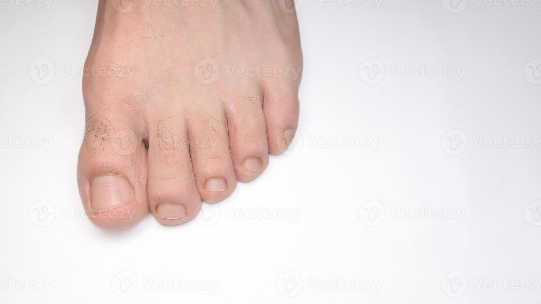 Close of a person left foot toes with white background and space for text photo