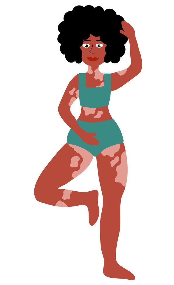 cuerpo positivo concepto. negro mujer con vitíligo. niña vistiendo traje de baño y en pie en actitud yoga. plano ilustración. vector