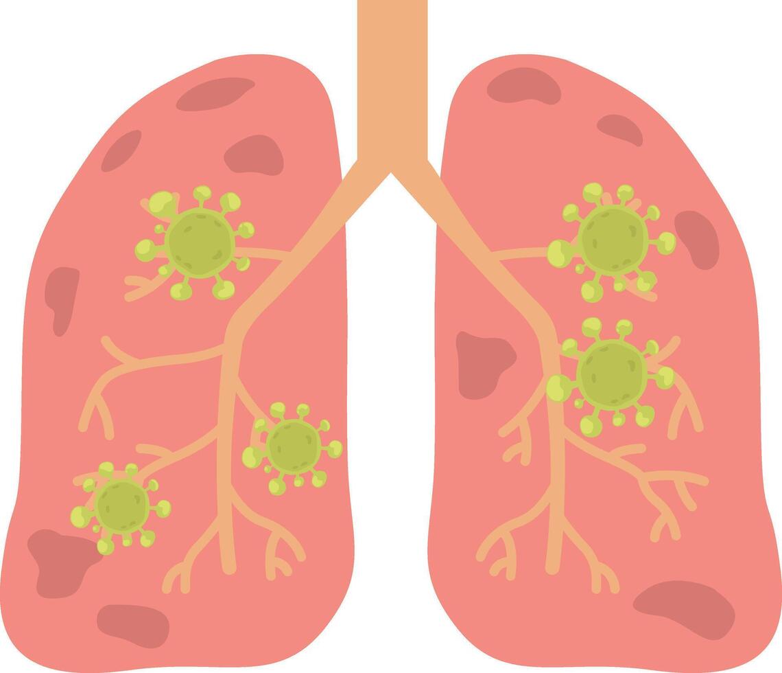 Virus or bacterial infects lungs.virus invades lungs. vector