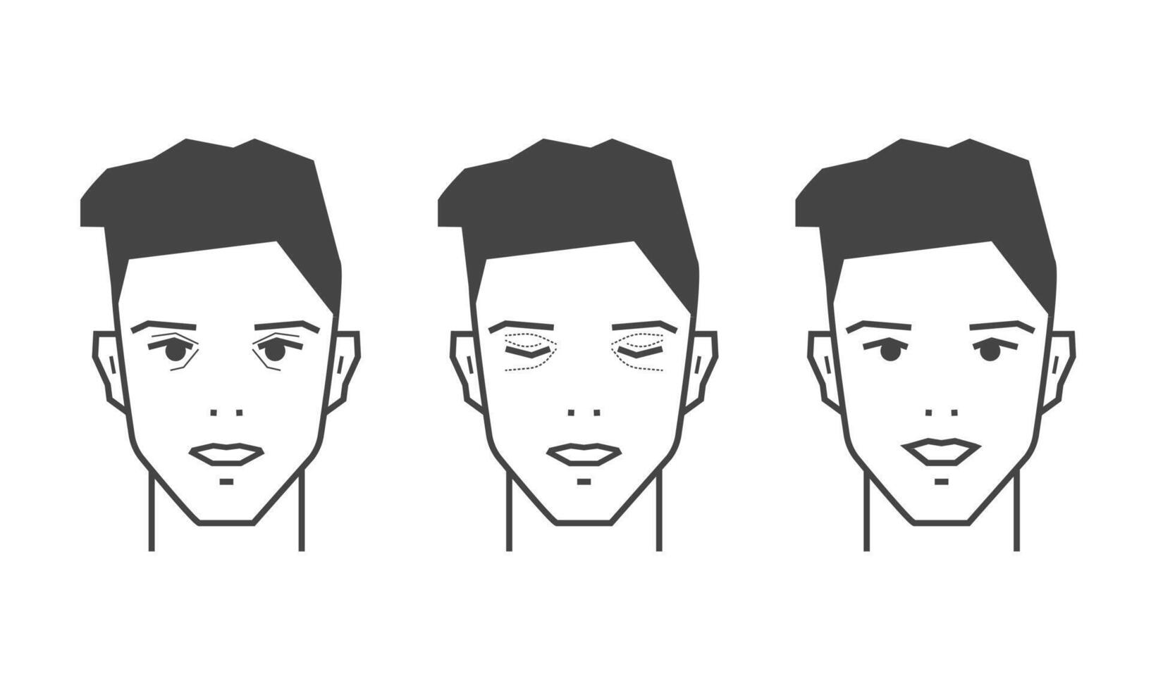 blefaroplastia iconos, el plastico cirugía concepto. piel corrección alrededor el ojos. ilustración vector