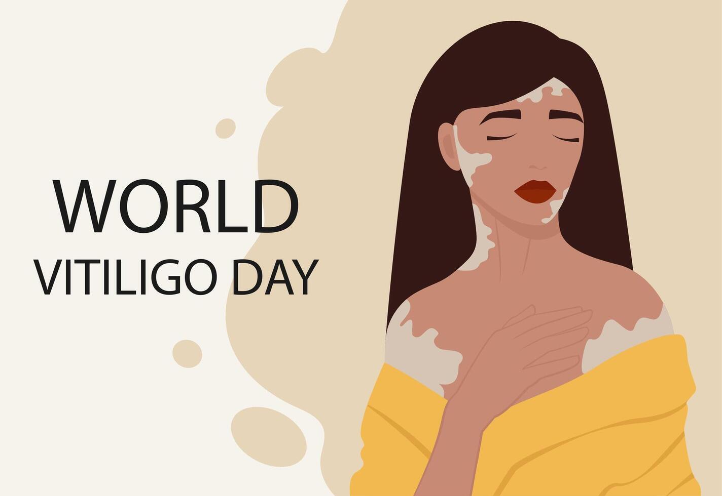 Young caucasian girl illustration with vitiligo banner. World Vitiligo Day. vector