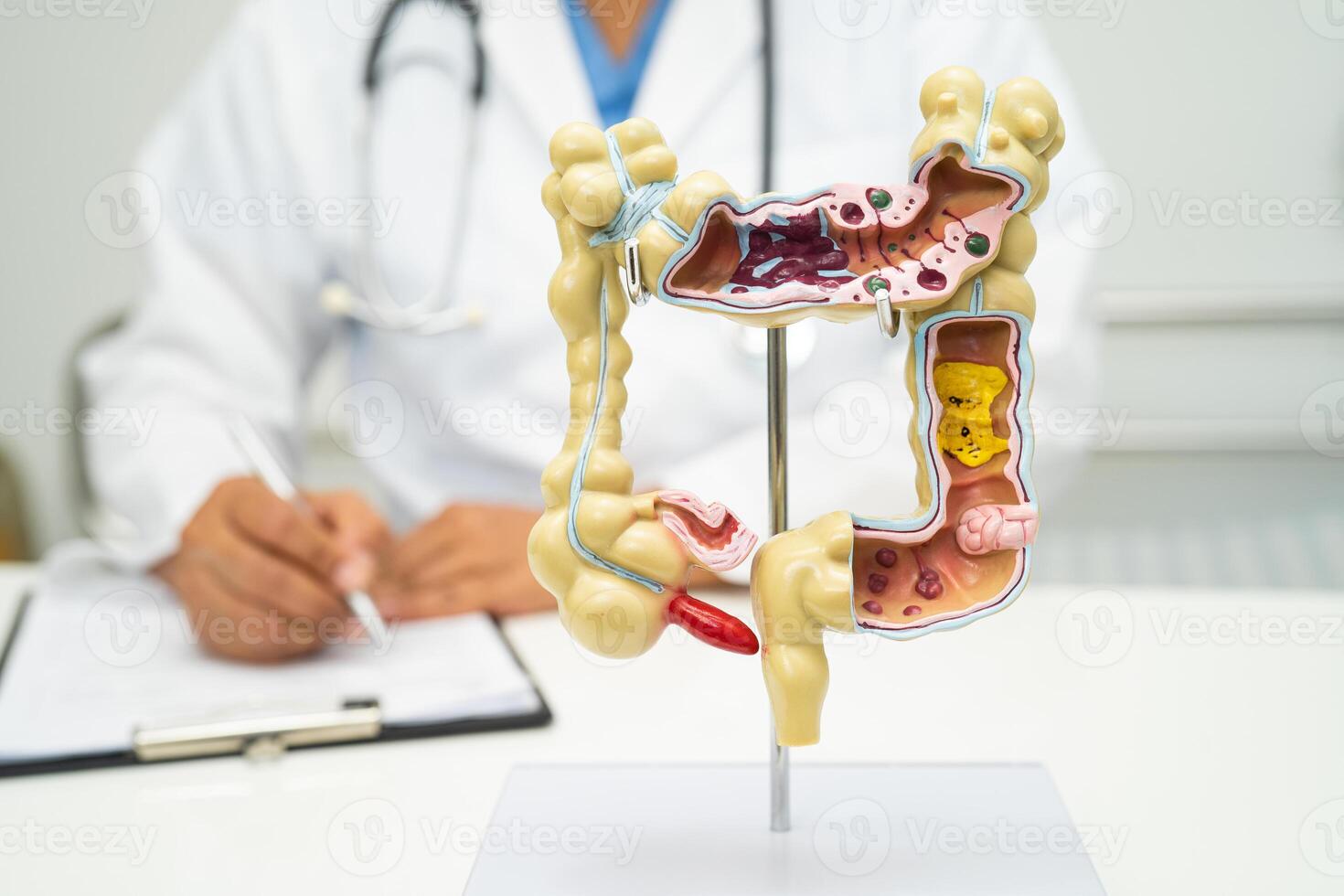 Intestine, appendix and digestive system, doctor holding anatomy model for study diagnosis and treatment in hospital. photo