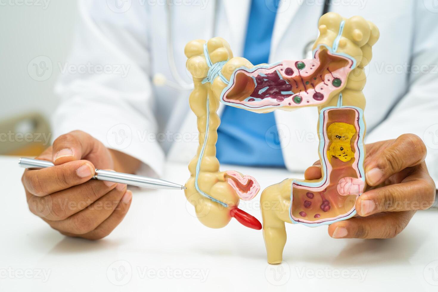 Intestine, appendix and digestive system, doctor holding anatomy model for study diagnosis and treatment in hospital. photo