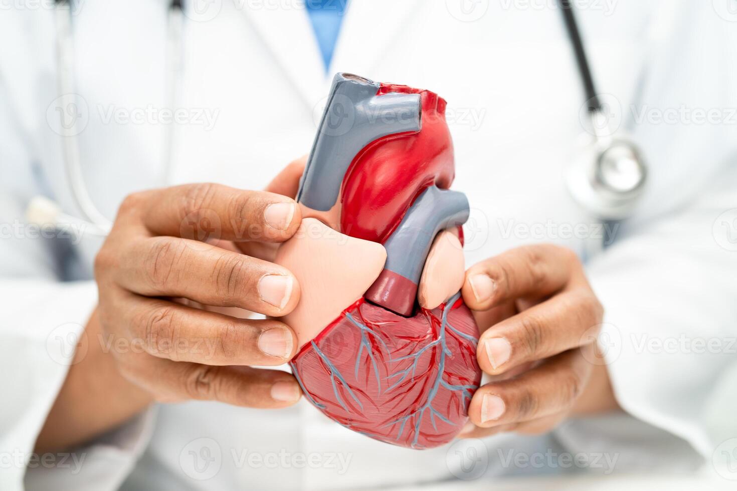 cardiovascular enfermedad CVD, asiático médico participación humano anatomía modelo para aprender y tratar corazón enfermedad. foto