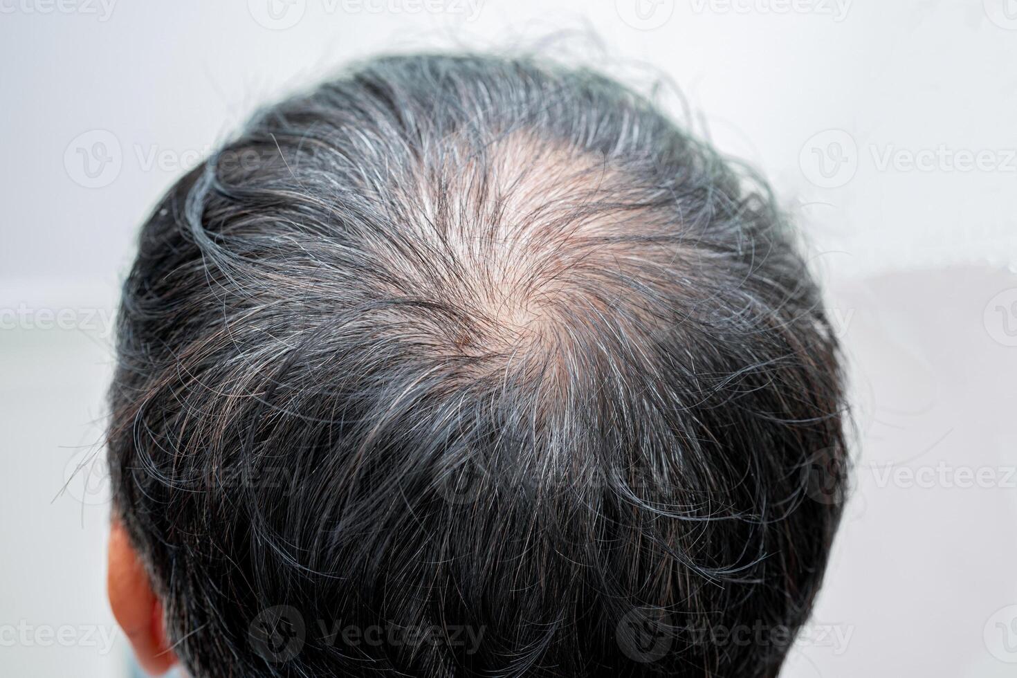 calvo en la cabeza media y sin pérdida de cabello glabro de hombre de oficina activo inteligente de negocios asiáticos maduros. foto