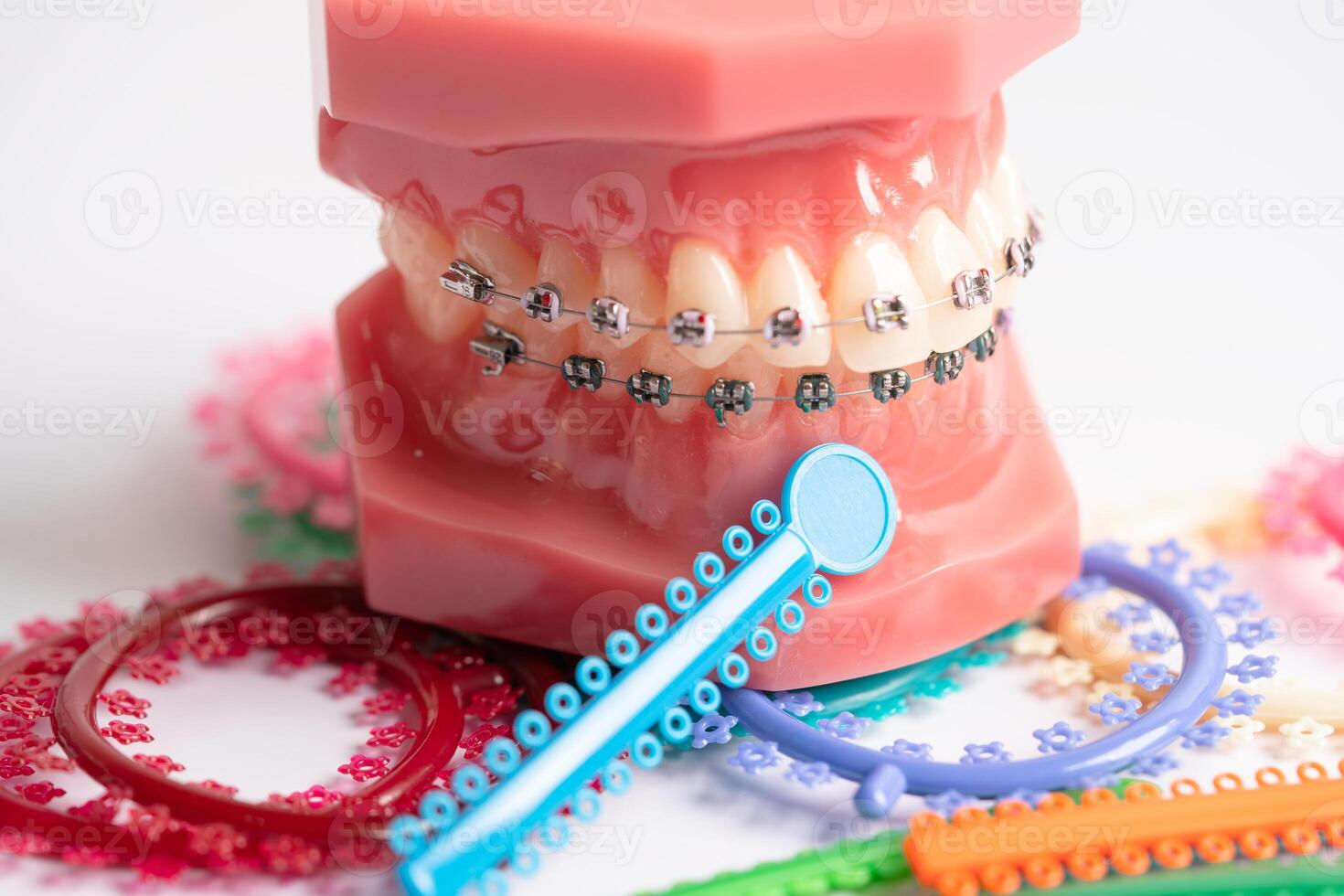 Orthodontic ligatures rings and ties, elastic rubber bands on orthodontic braces, model for dentist studying about dentistry. photo