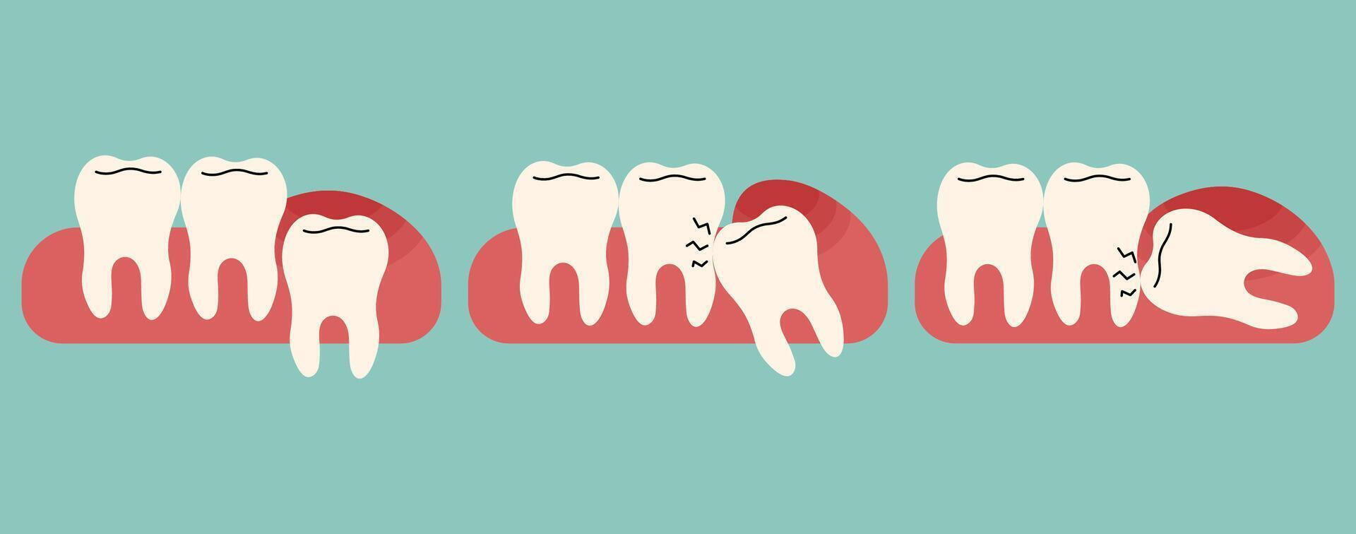 Wisdom teeth 1 cute on a blue green background, illustration. vector