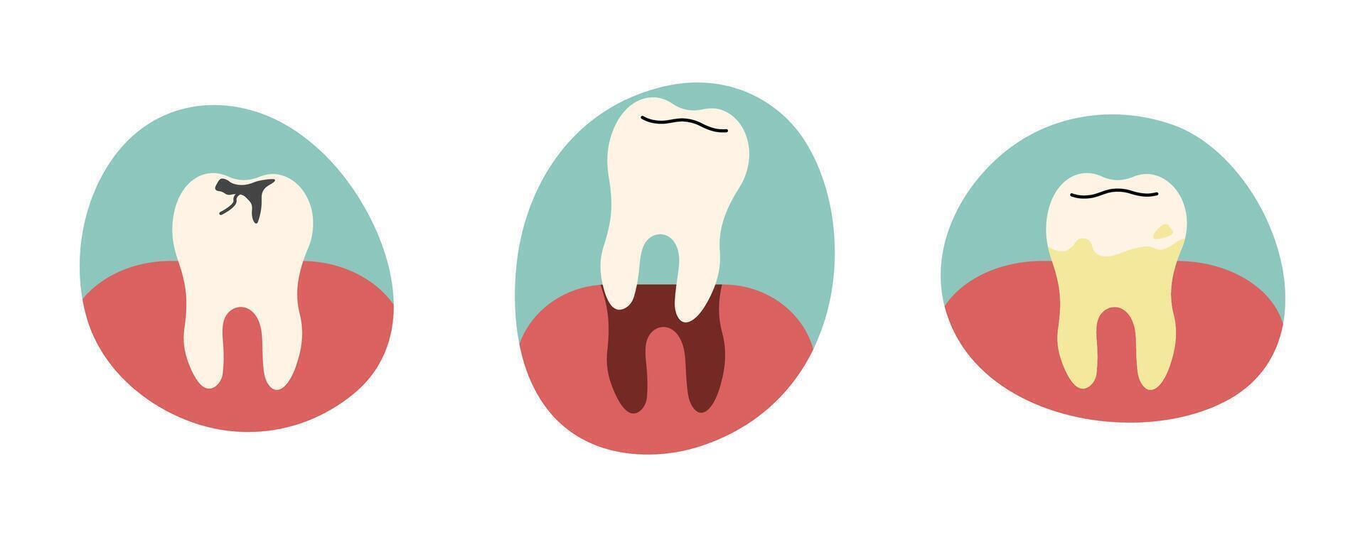 Teeth 11 on a white background, illustration. vector