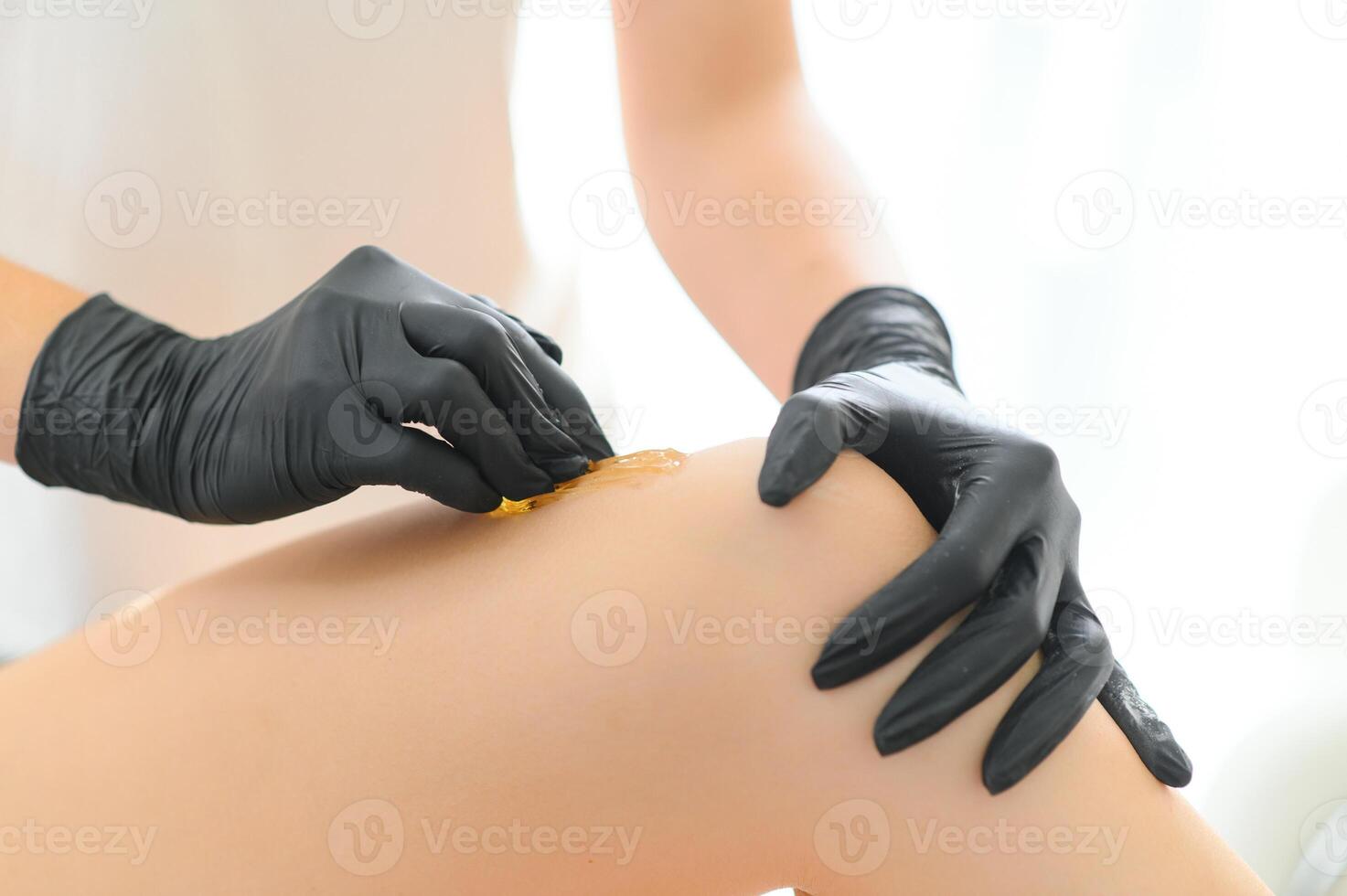 Sugaring epilation skin care with liquid sugar at legs close-up. Beauty and cosmetology concept. photo