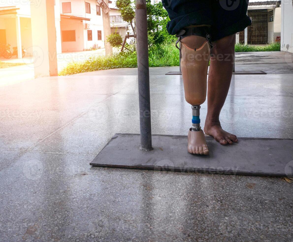 discapacitado joven mujer tratar a caminar con prótesis foto