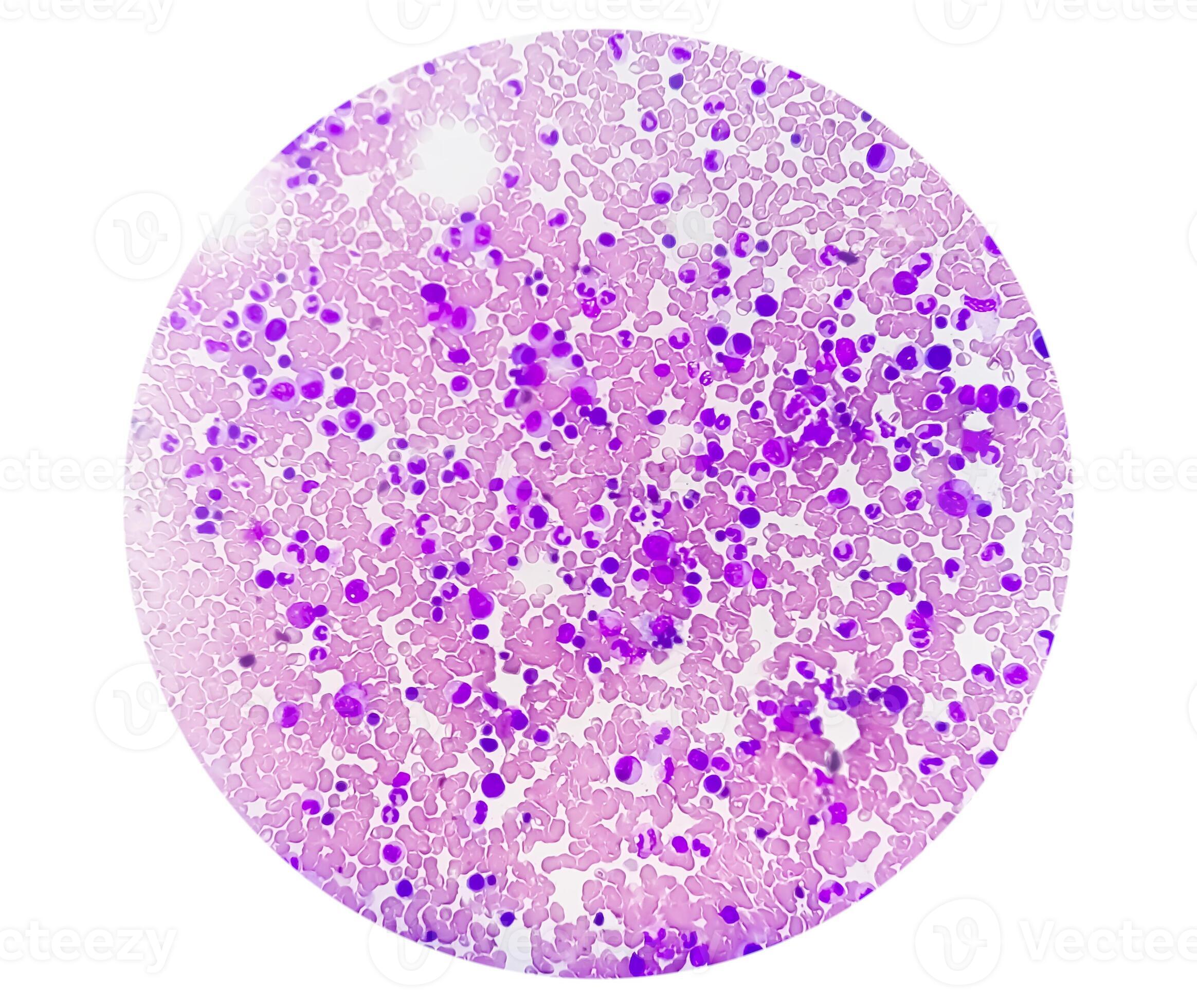 Astonishing Details: A Labeled Photomicrograph Of Bone! - 3oqssl1