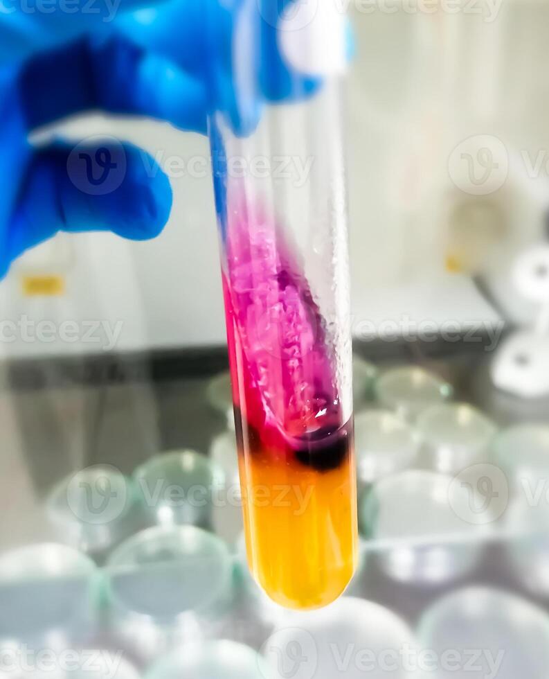 Salmonella detection method by using Triple Sugar Iron or TSI Agar in microbiology laboratory. photo